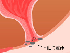 老年人肛门瘙痒的原因总结