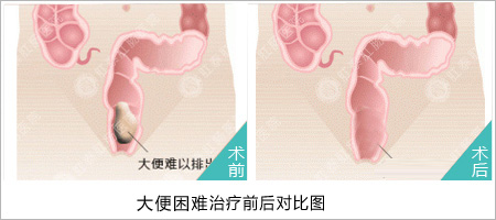 福州医博医院