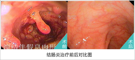 福州医博肛肠医院