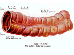 结肠炎时好时坏怎么回事？