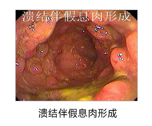 福州肛肠医院