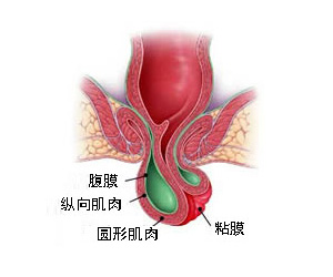 女性脱肛图片是什么？