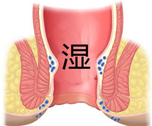 肛门总是有点湿湿的是怎么回事！