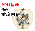 医博智能PPH除Ⅲ期内痔无弊端