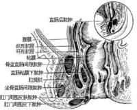 便秘的危害严重吗